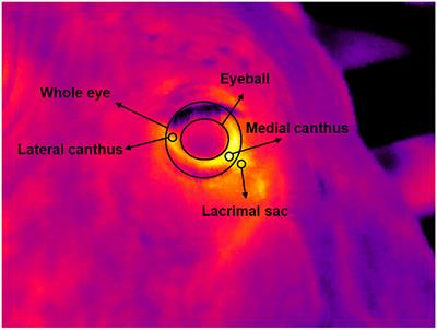 Evaluation of the Best Region for Measuring Eye Temperature in Dairy Cows Exposed to Heat Stress